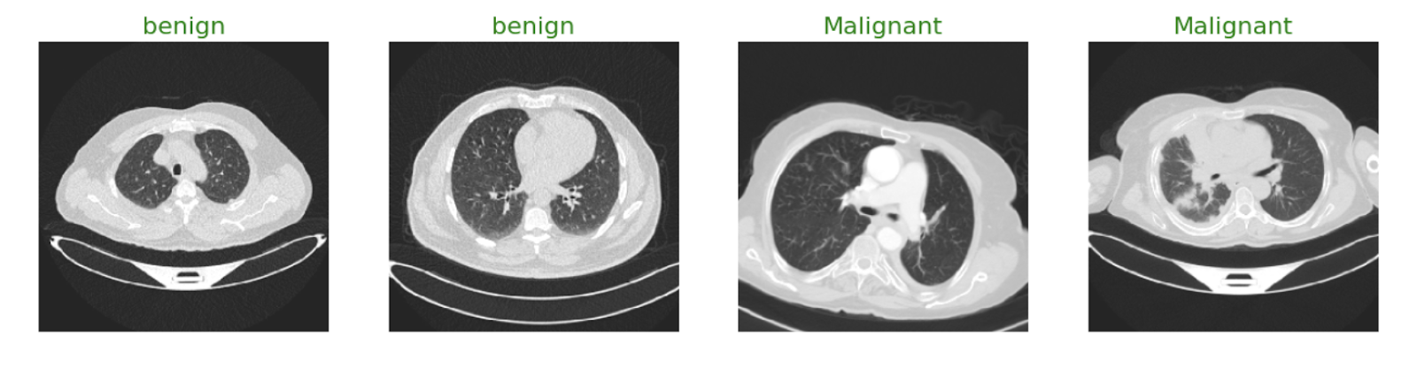 Sample CT scan images from the lung cancer dataset